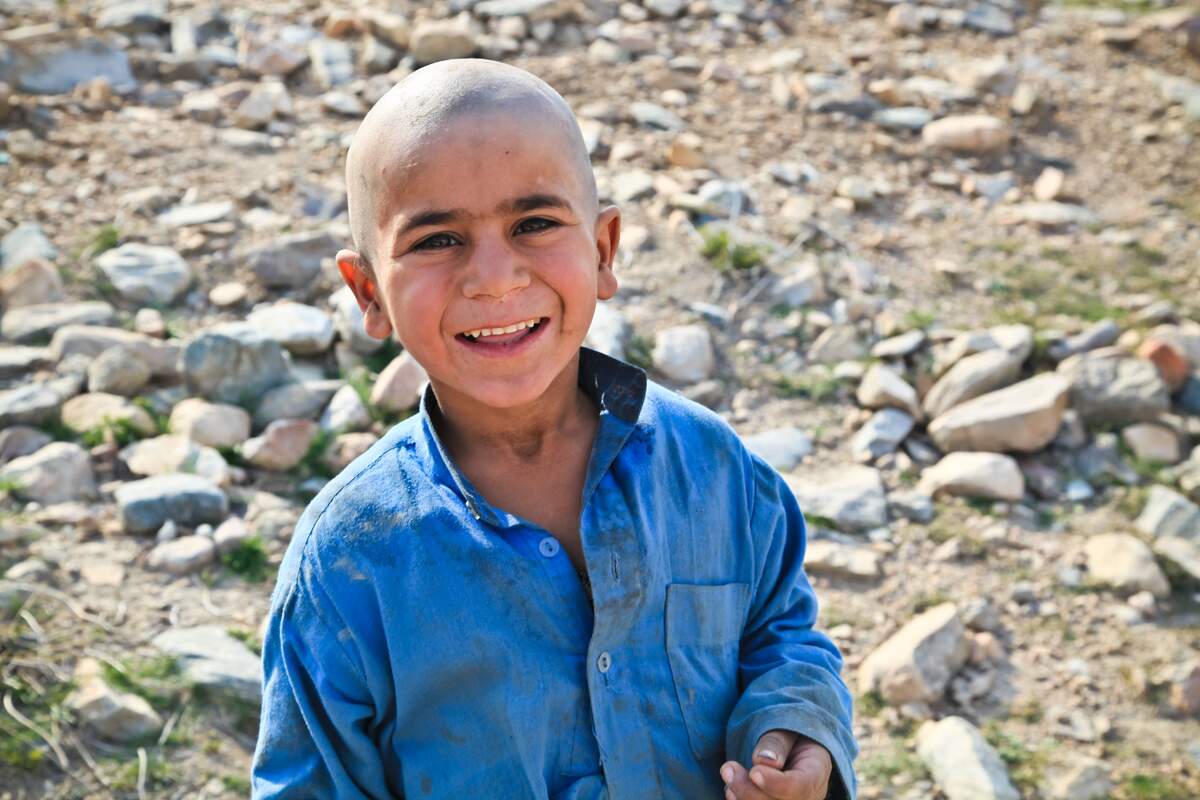 Bald is Beautiful Day