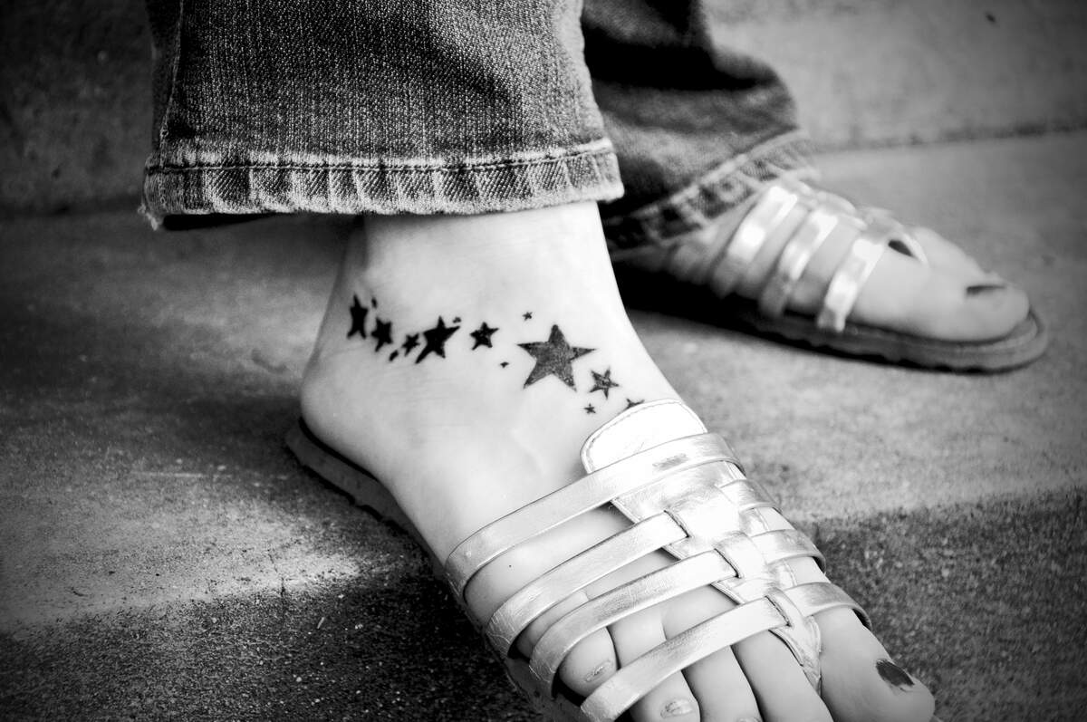 National Tattoo Removal Day